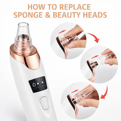 Handled Pore Vacuum Cleaner - Clear Your Pores in Minutes No Squeezing Needed